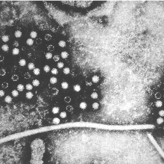 hepatitis e virus igg antibody (hev igg) test